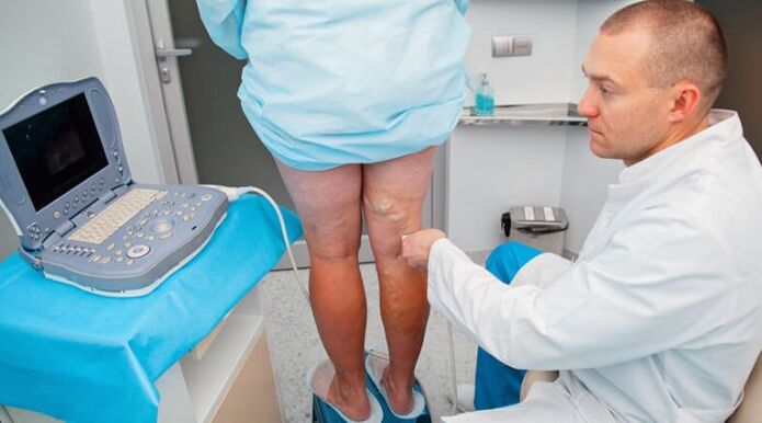 Varikozės venų diagnozė